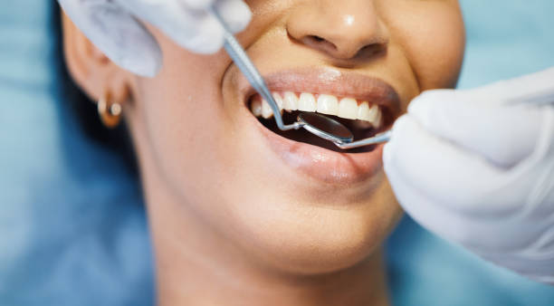 Best Emergency Tooth Extraction in Prosper, TX