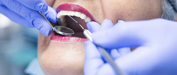 Best Emergency Root Canal Treatment in Prosper, TX